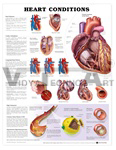 Heart Conditions Anatomical Chart